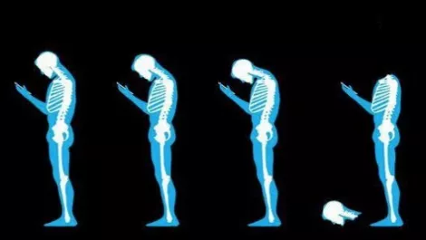 Text Neck: Is your smartphone wrecking your spine?