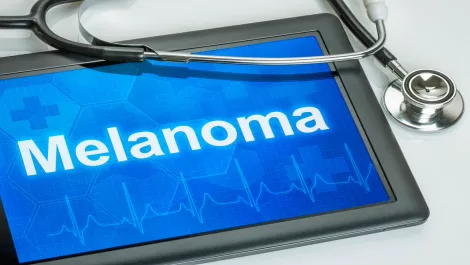 Melanoma detection app has been saving Kiwi lives