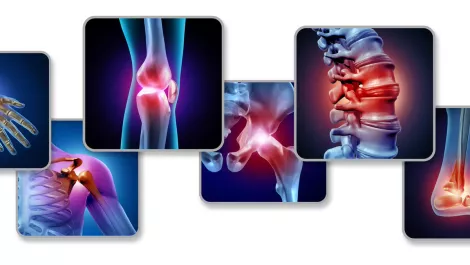 Scientists use 3D printer to print 'bone' with living cells